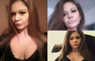 Cum arată Andreea, tânăra cu cele mai mari buze din lume, refuzată de stomatologi să-i trateze o carie din cauza buzelor uriașe