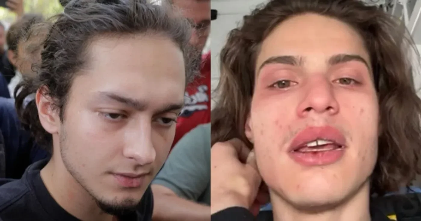 Imagine articol