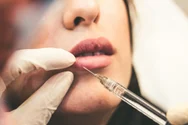 Mitul măririi buzelor cu botox: ce spun medicii esteticieni despre singura opțiune corectă