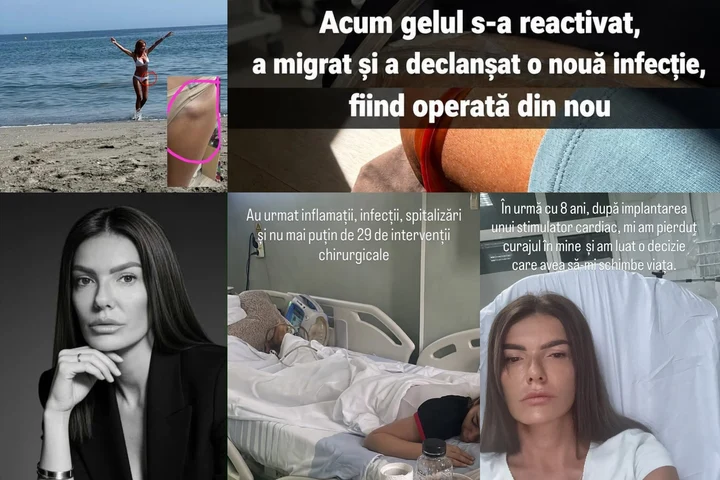 „Pot muri în orice clipă.” Mărturia cutremurătoare a unei femei care trăiește cu teama că o procedură estetică încercată și de vedete îi poate provoca un șoc septic
