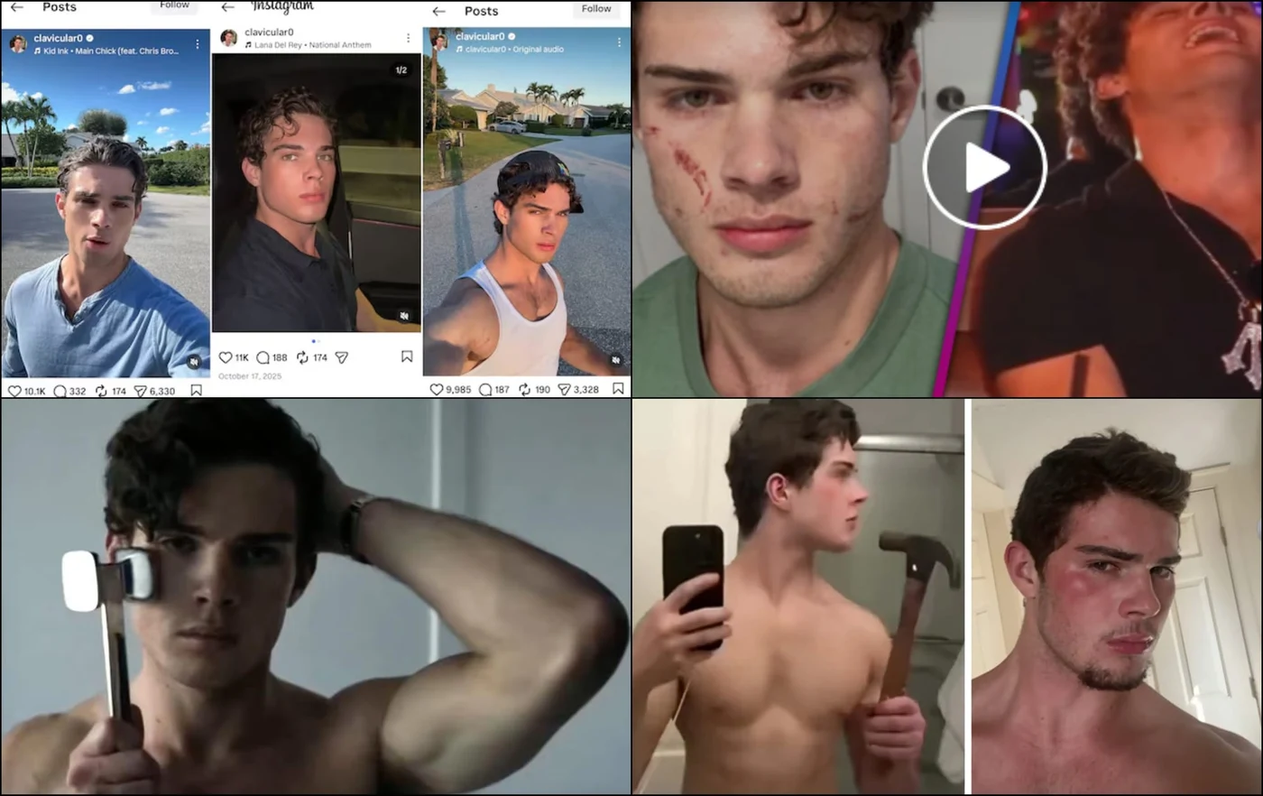 Fenomenul „Clavicular” este răspândit de către Braden Eric Peters, un tânăr de 20 de ani din Statele Unite