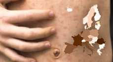 Cazurile de pojar s-au înmulțit puternic în Europa. România este în frunte!
