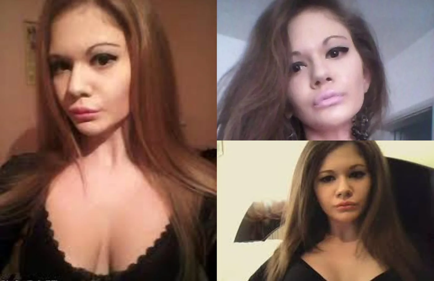 Andrea Ivanova, înainte de intervenția estetică de la buze
