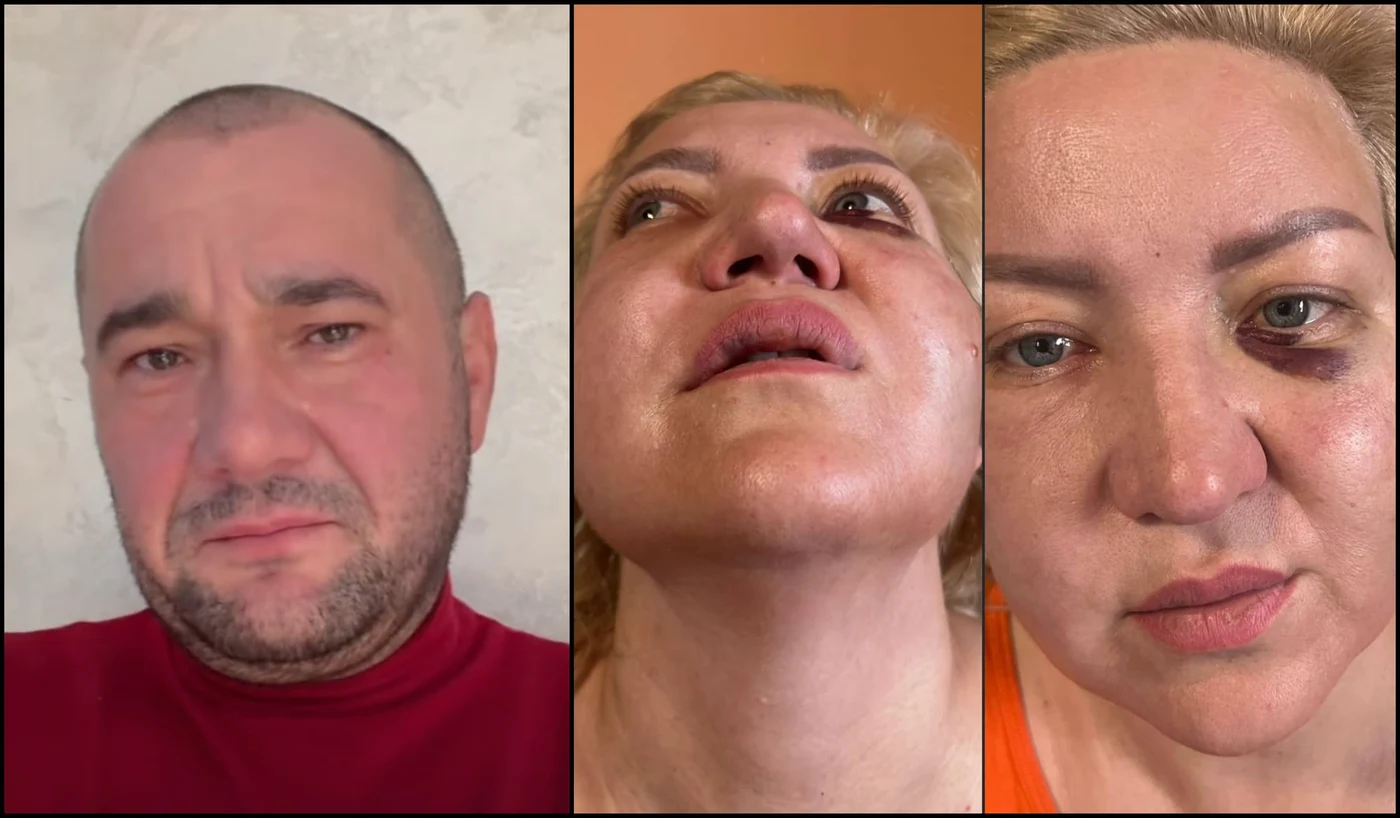 Primarul Radu Reziuc (PSD) este acuzat că a bătut-o atât ăe fosta parteneră de viață, cât și pe fiica acesteia