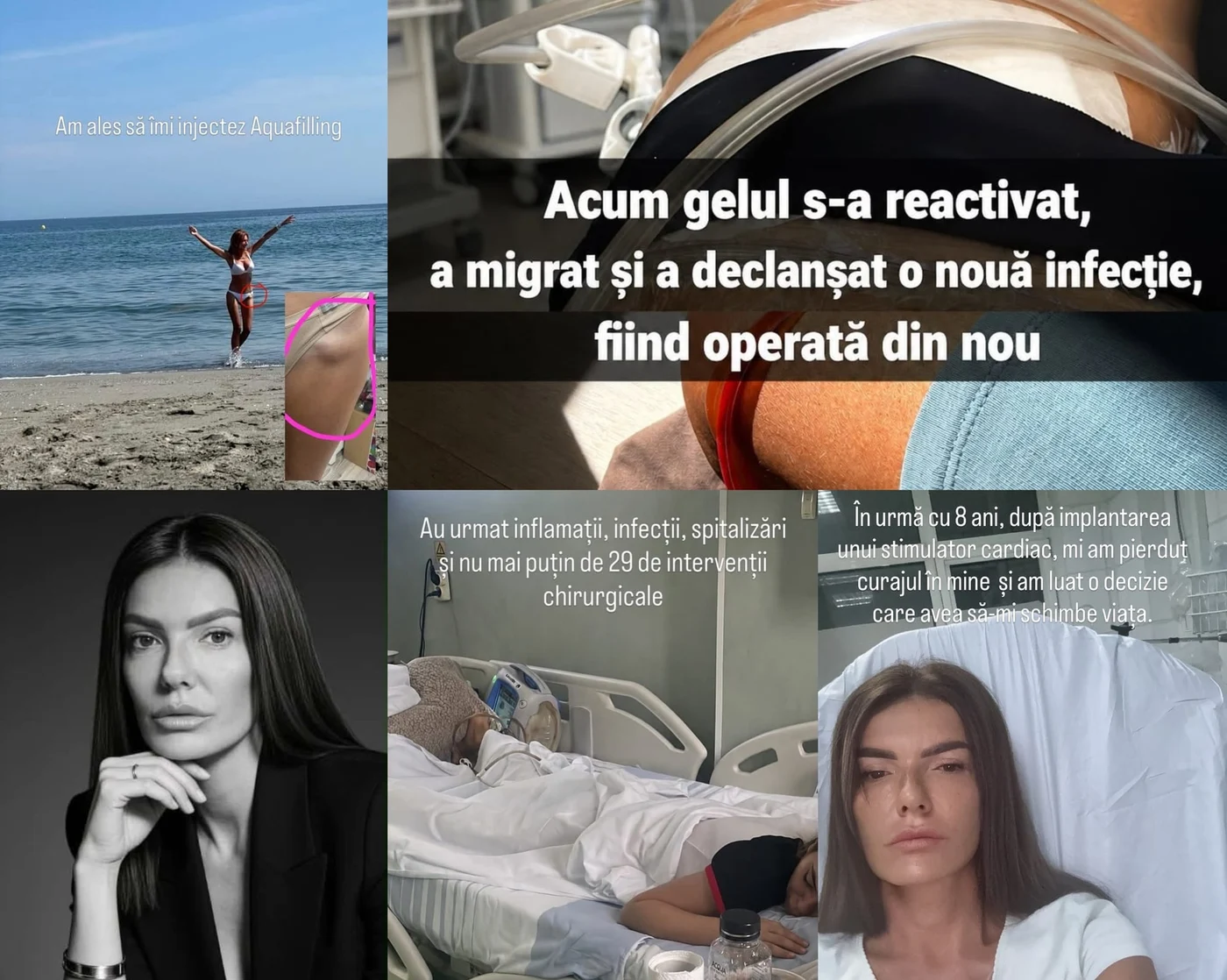 Aquafilling-ul i-a dristru viața unei femei din Galați.