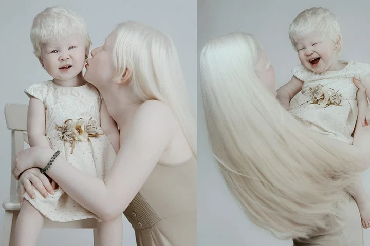 Surorile albino din Kazahstan, născute la 12 ani distanță, au cucerit internetul. Povestea rară care fascinează milioane de oameni