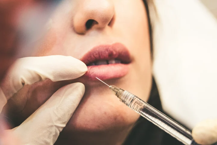 Mitul măririi buzelor cu botox: ce spun medicii esteticieni despre singura opțiune corectă