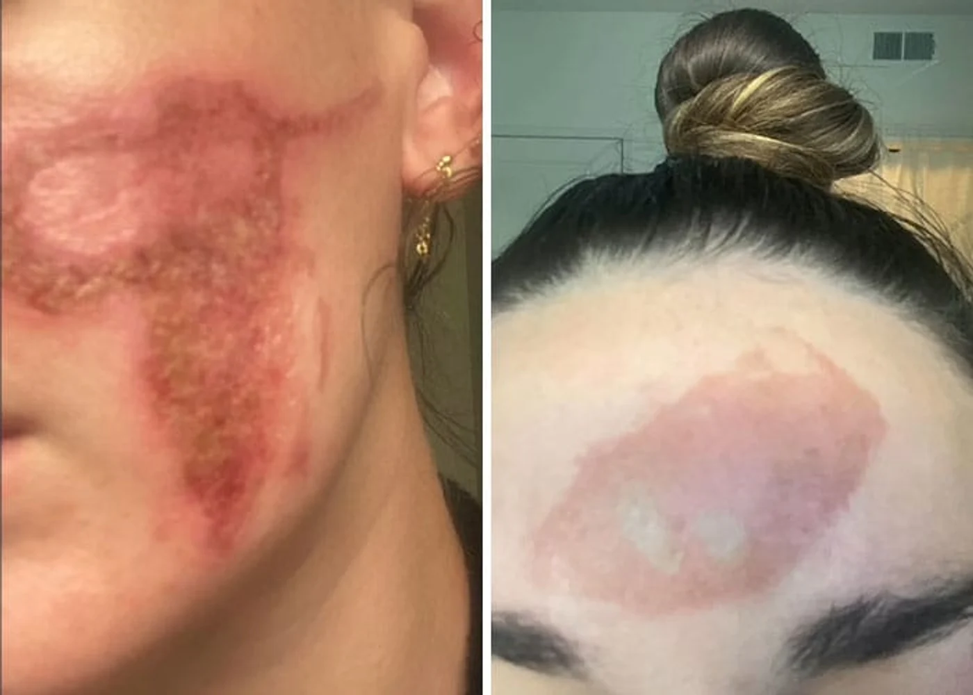 Imagine galerie articol