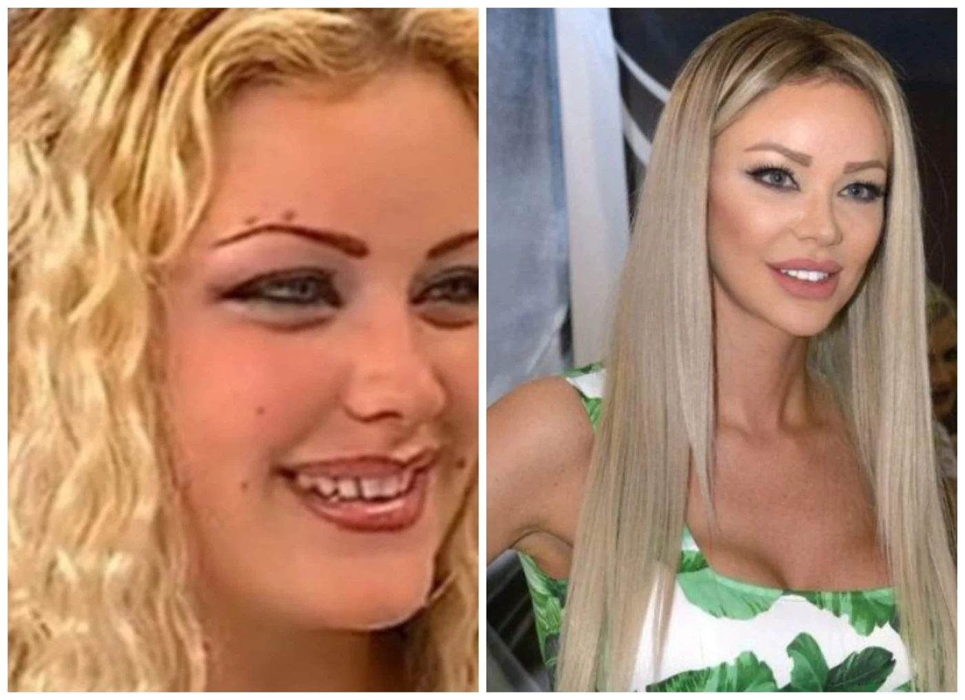 Imagine galerie articol