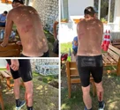 Atac brutal pe un traseu turistic din Apuseni: Antrenor de atletism, sfâșiat de o haită de 8 câini în plină alergare