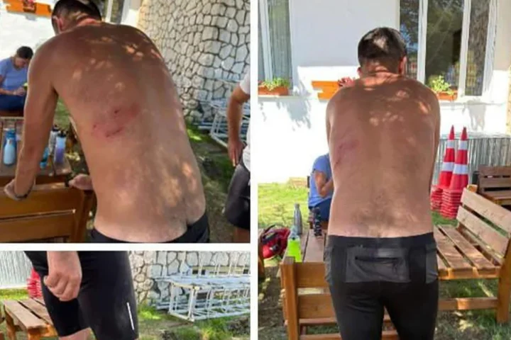 Atac brutal pe un traseu turistic din Apuseni: Antrenor de atletism, sfâșiat de o haită de 8 câini în plină alergare