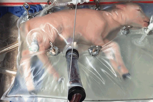 Tehnologia uterului artificial: Deliberări asupra testelor pe oameni în SUA