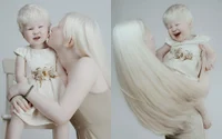 Surorile albino din Kazahstan, născute la 12 ani distanță, au cucerit internetul. Povestea rară care fascinează milioane de oameni